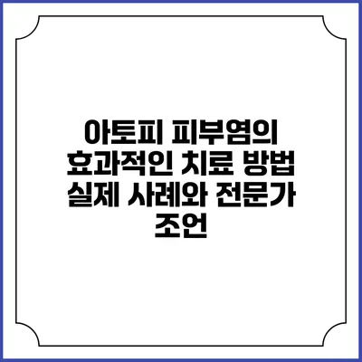 아토피 피부염의 효과적인 치료 방법: 실제 사례와 전문가 조언
