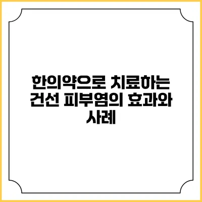 한의약으로 치료하는 건선 피부염의 효과와 사례